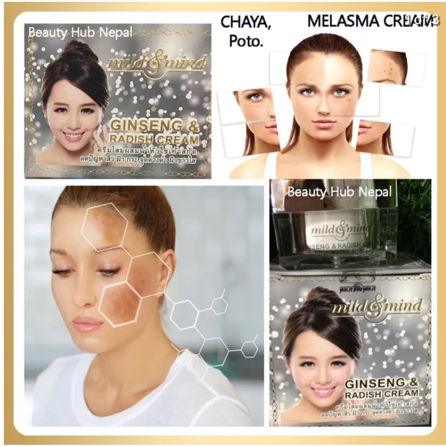 Best For Melasma Mild & Mind Cream (From Thailand) # 5248 # 990