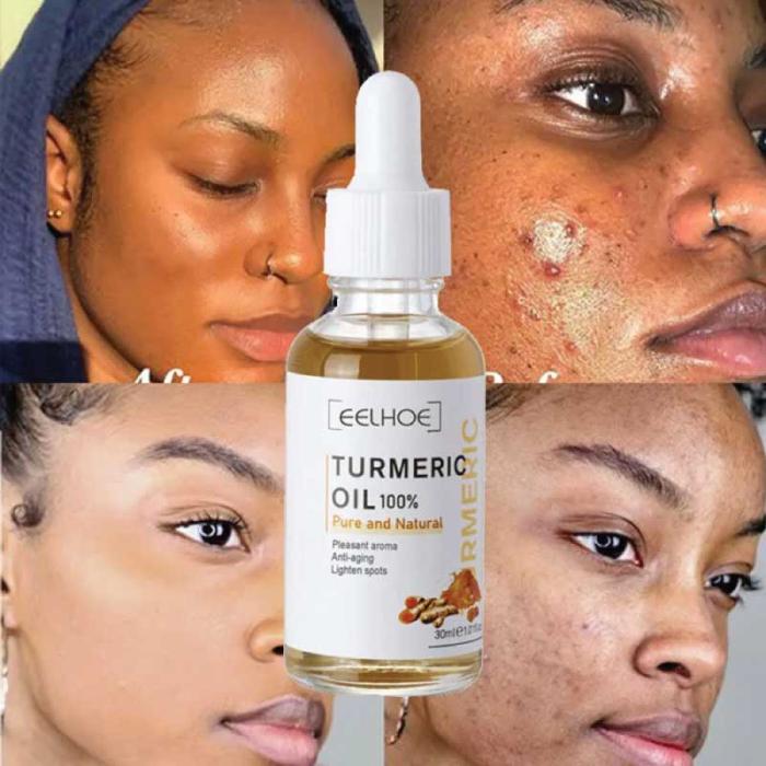 DARK SPOT CREAM