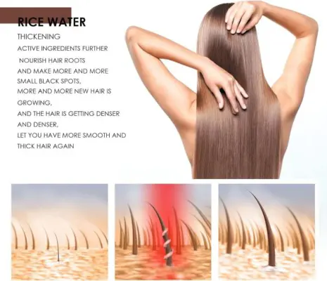 Rice Water Hair Care Shampoo – Hair Fall Control, Dandruff Removal, Volume Boost, Regrowth & Thickening Formula
