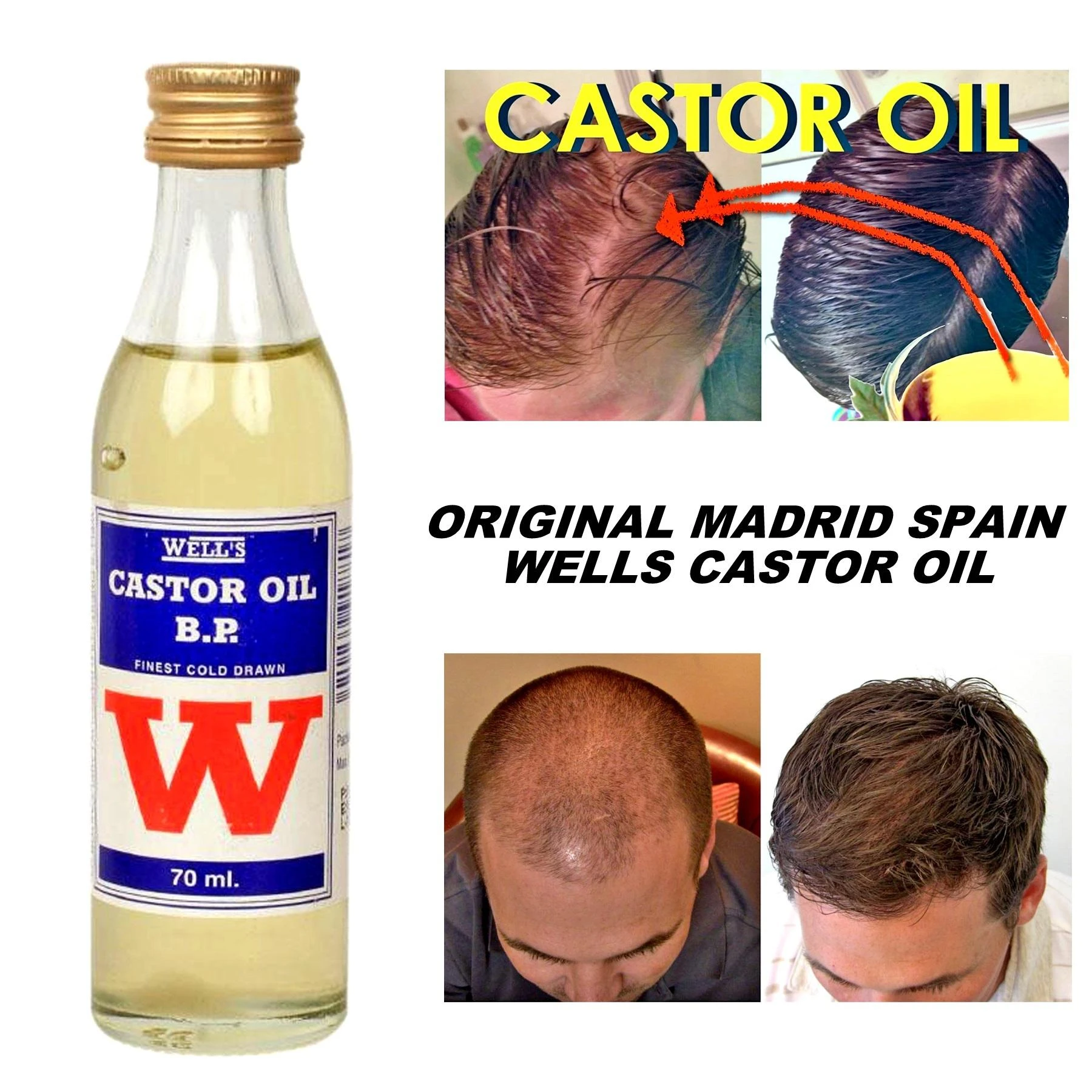 Wells Castor Oil 70ml