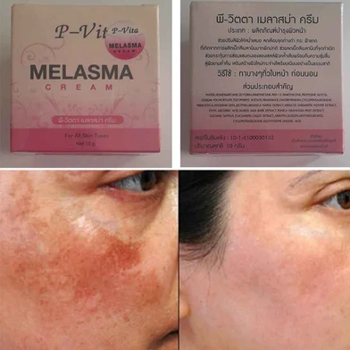 Bioaqua P Vita Melasma Mesta Whitening Cream -10 gm (Thailand)